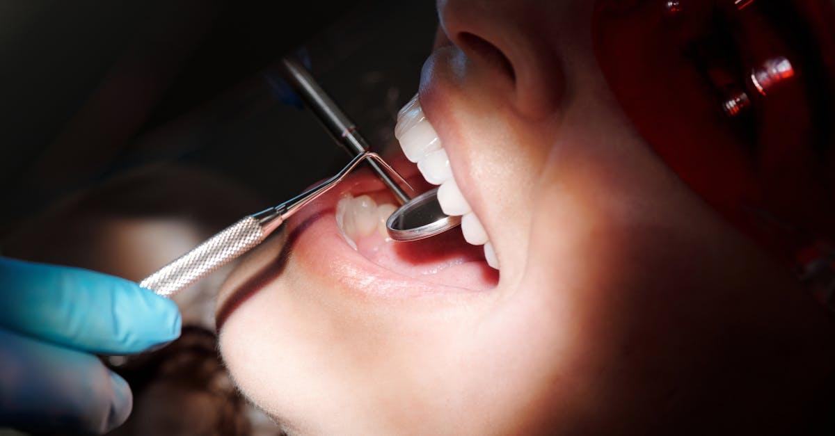 You are currently viewing Effektiv tandretning med togskinner